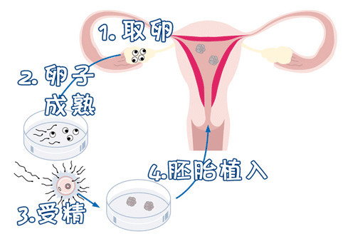 中医妇科